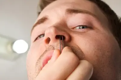 Benarkah Mencabut Bulu Hidung Bisa Sebabkan Radang Otak dan Kematian?