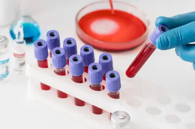 Golongan Darah B Berisiko 28 Persen Lebih Tinggi Terkena Diabetes Tipe 2