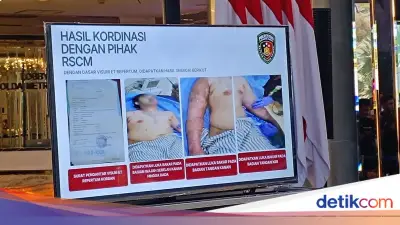 Komnas HAM Tegaskan Istilah Medis 'Zat Kimia Asam Kuat' untuk Kasus Andrie Yunus