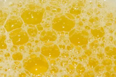 Pemeriksaan Urine Penting untuk Deteksi Dini Radang Ginjal di Usia Muda