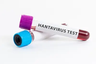 Hantavirus Bukan Flu Biasa, Tingkat Kematian Capai 40 Persen