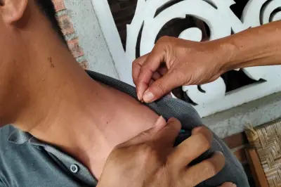 Terapi Lebah: Manfaat Madu, Propolis, hingga Sengatan untuk Kesehatan