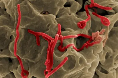 Wabah Ebola di Kongo: 246 Kasus, 80 Meninggal, Menyebar ke Uganda
