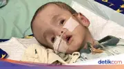 Anugerah Bayi 6 Bulan Hidrosefalus Berjuang Sembuh, Butuh Donasi