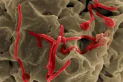Wabah Ebola di Kongo: 246 Kasus, 80 Meninggal, Menyebar ke Uganda