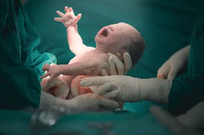 Bayi Alami Kerusakan Otak, NHS Bayar Ganti Rugi Rp 678 Miliar