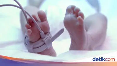 RSUD Prambanan Akan Klarifikasi ke Polisi Soal Kematian Balita Usai CT Scan