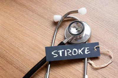 Intervensi Vaskuler Kurangi Risiko Stroke Berulang secara Efektif