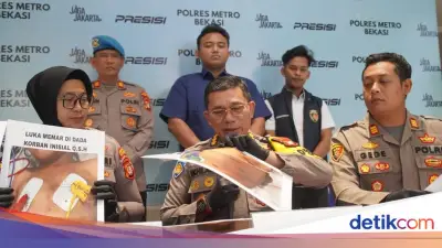 Polisi Usut Tuntas Kasus Bocah 4 Tahun Tewas Dianiaya Ibu Tiri di Bekasi