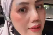 Elly Sugigi Tak Dapat Restu Anak Saat Operasi Plastik