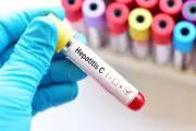 Hari Hepatitis Sedunia, Momentum Tingkatkan Kesadaran terhadap Hepatitis B dan C