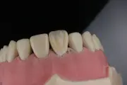 Klinik Gigi di China Cabut 12 Gigi Pasien Tanpa Izin, Kena Sanksi